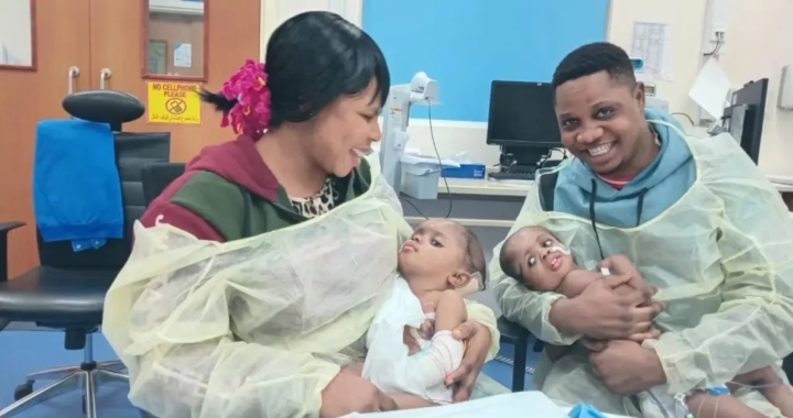 Separated at the Skull, Rare Twin Sisters Embrace a New Life After Groundbreaking AI-Assisted Surgery